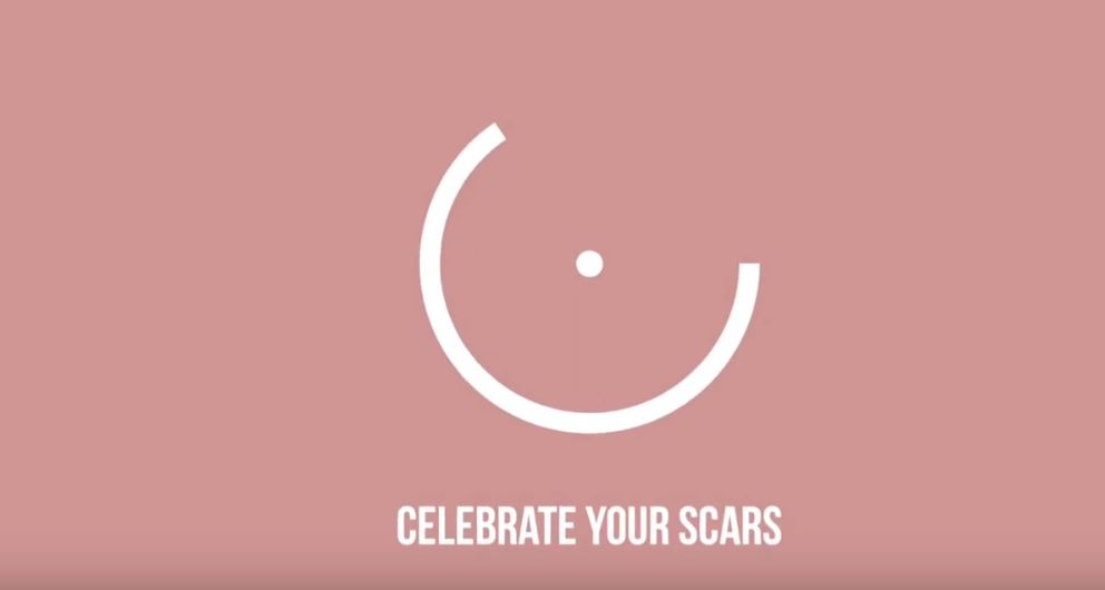 Celebrate Your Scars